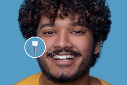 Teeth Chip