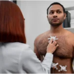 Gynecomastia
