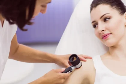 Say Goodbye to Moles with Advanced Laser Technology