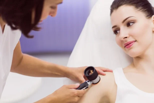 Say Goodbye to Moles with Advanced Laser Technology