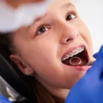 emergency orthodontic care